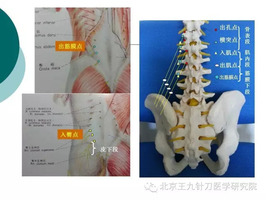 腰臀部软组织损伤的针刀治疗