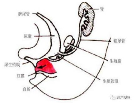 脐尿管癌非常少见,田军教授曾总结北京中国医学科学院肿瘤医院1978年