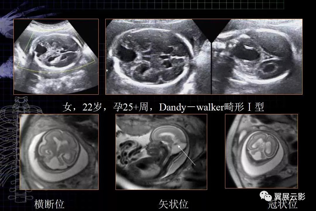 胎儿磁共振解剖图谱