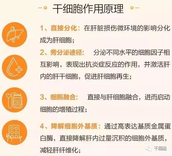 汉氏联合肝硬化的干细胞疗法作用原理