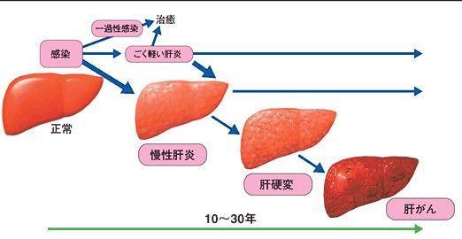 需要具体分析这种情况,需要化验肝功,甲乙丙丁戊型肝炎病毒,血脂做个