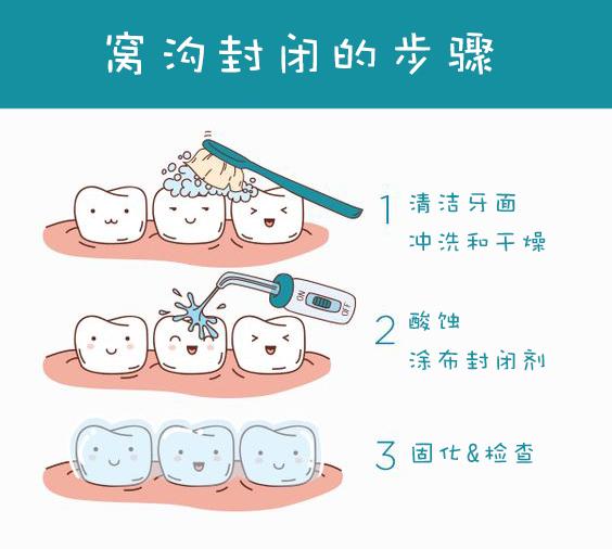 『做窝沟封闭会痛吗』保护新生恒牙最直接,最有效的方法.