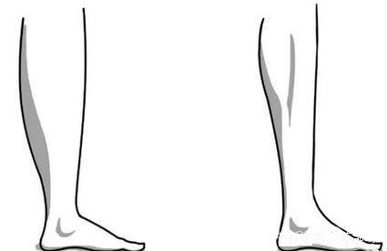 这2种腿型的瘦小腿方法,教你瘦小腿,塑造完美腿部线条