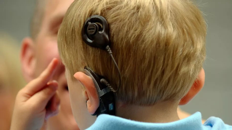 人工耳蜗植入之前应该知道哪些问题?