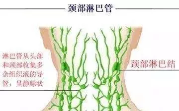 人的身体里共有800多个淋巴结,其中最能反应我们健康的是颈部淋巴