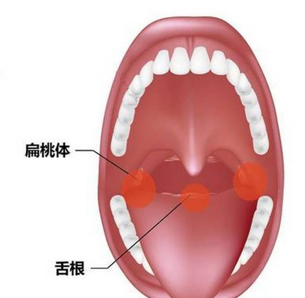 喉咙卡了鱼刺怎么办