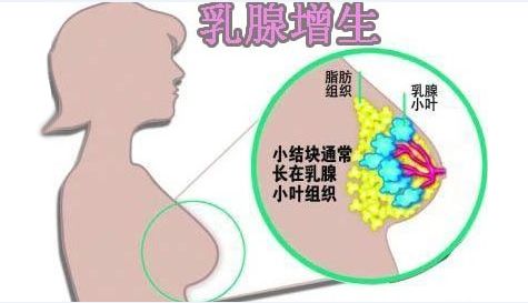 医生我不想做手术,太舒特乳腺贴