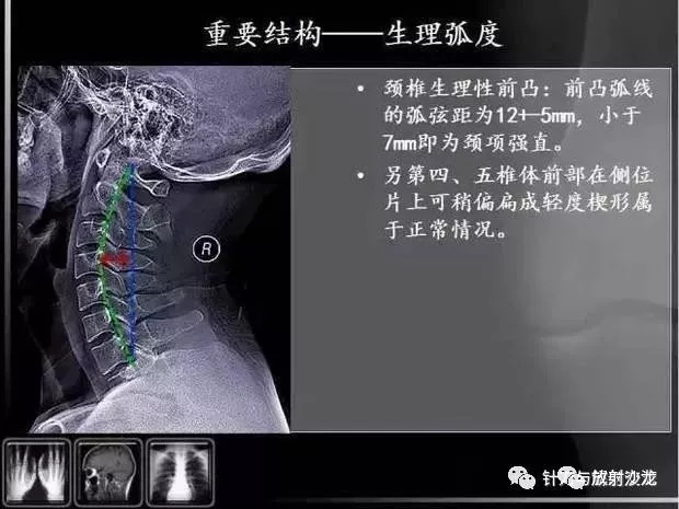 教你如何看懂颈椎x线片阅片的基础知识