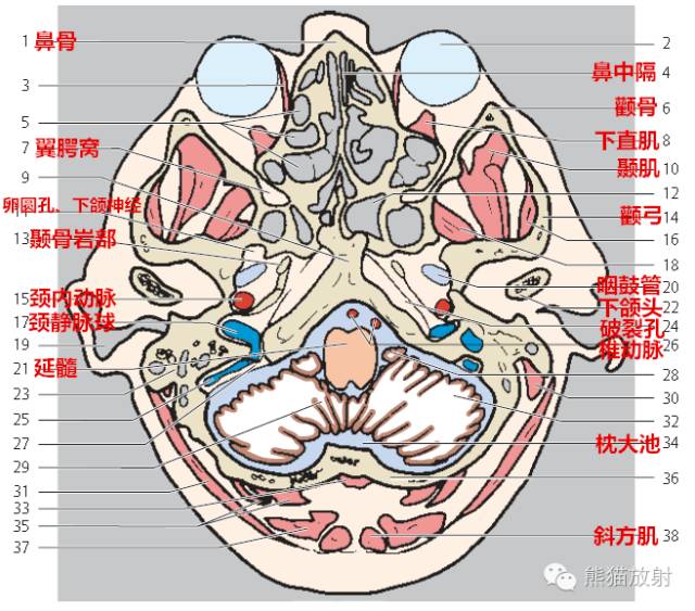 解剖入门颅脑ct断层中英文对照