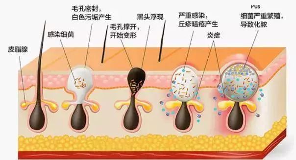 由于皮脂腺会持续分泌出油脂