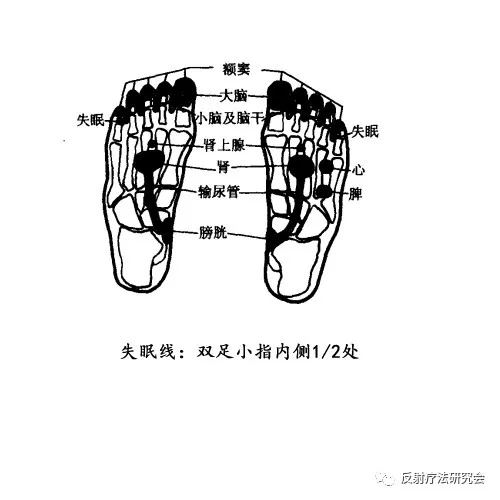 天天失眠睡不着觉怎么办