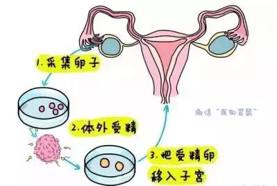 四,试管婴儿的成功率如何?