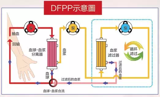 回血的原理_关于王者荣耀回血机制的分析