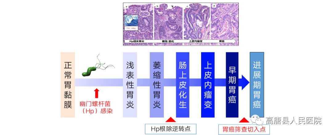 胃病早发现我院检验科开展胃功能检查