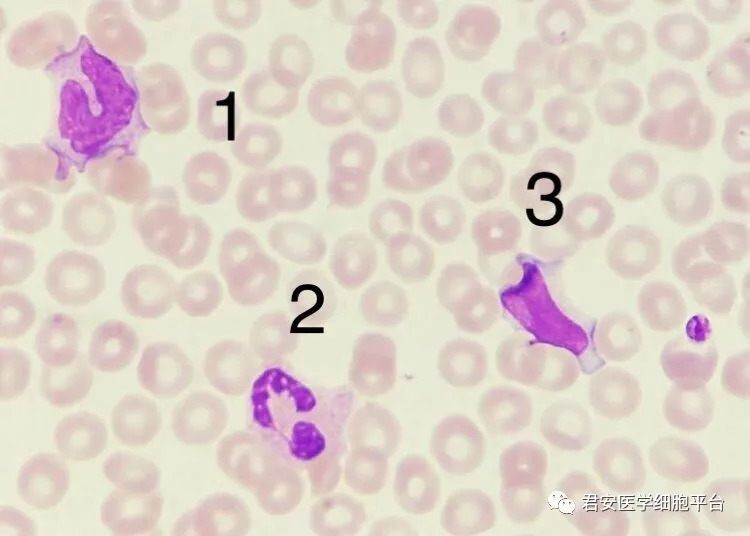 胞质中含细小的紫红色颗粒和少量空泡;胞核扭曲,折叠,呈马蹄形;染色质