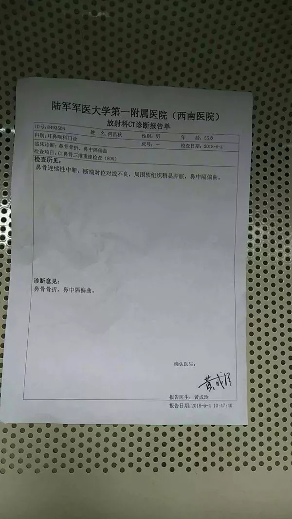 何昌秋提供的ct诊断报告单