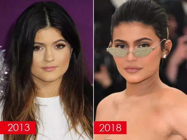 和整形之前对比,kylie jenner的嘴唇从s码变为xxl