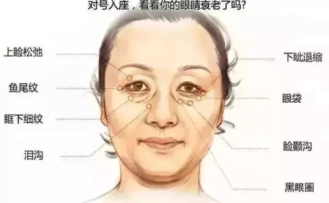 你眼周出现细纹了吗?