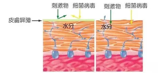 健康皮肤屏障和受损的皮肤屏障