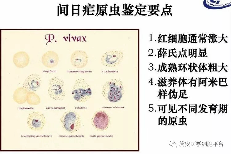 「间日疟原虫雌配子体」 形态特征:感染虫体的红细胞涨大,外形规整