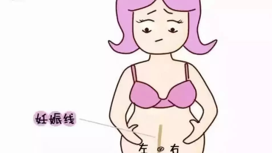 孕肚上的黑线可以分辨男女吗