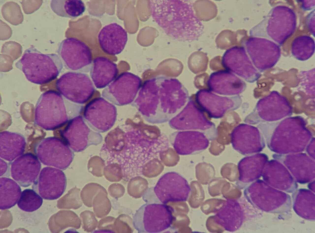 临床血液学检验技术 正常细胞形态学观察实验报告 红蓝铅笔 - 知乎