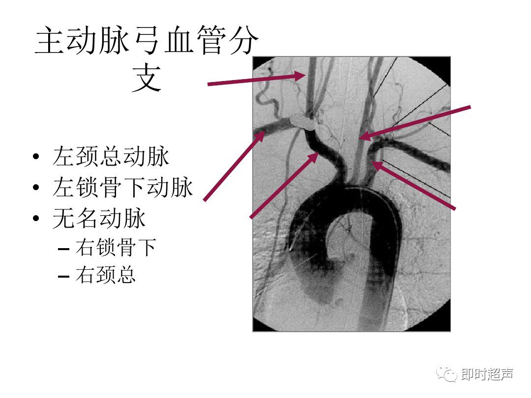 颈部血管超声正常解剖及常见病的超声诊断标准