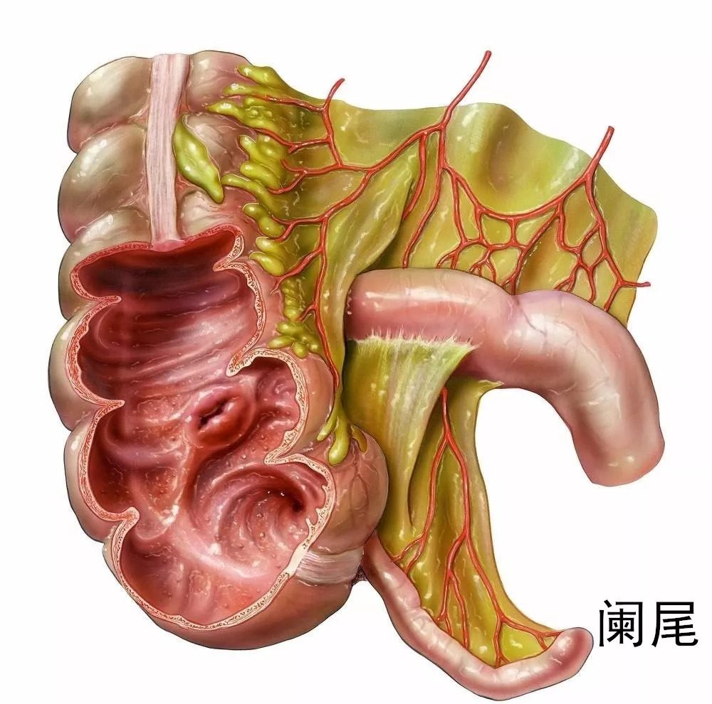 饭后运动练坏盲肠浅谈阑尾炎的那些事儿