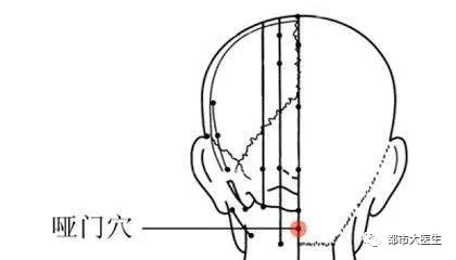 当然如果不想喝,用按的也行啊 ● 睡眠用梳子梳哑门穴 额.口臭!