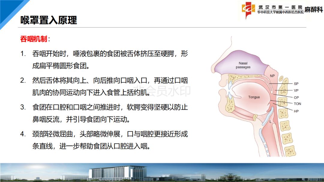 麻醉讲堂经典喉罩置入技术