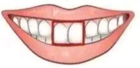 门牙的形状看命运,你是哪一个?