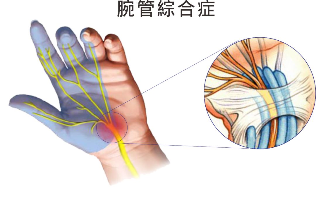 7亿白领的健康杀手