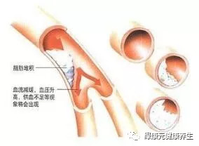 搭脉怎么看脑供血不足_脑供血不足怎么调理(2)