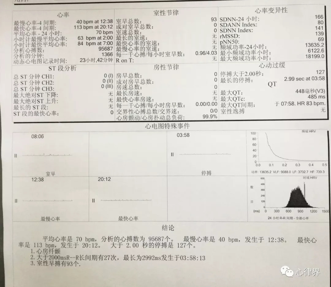 holter:※超声心动图:※ 心电图:检查相关4,入院相关检查:病人脑电