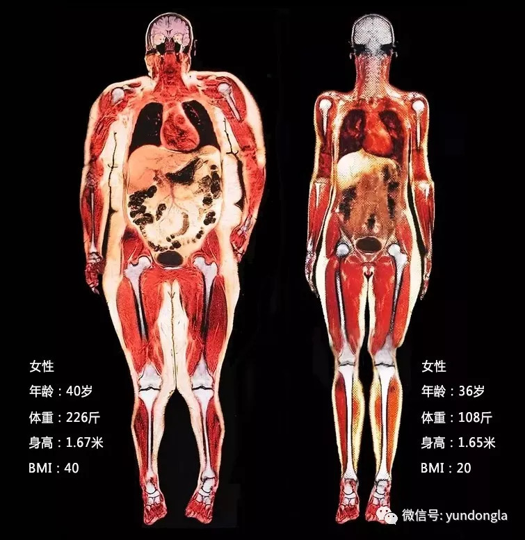 还给全身五脏六腑造成了极大的负担,让身体越来越糟,以致于危及生命.