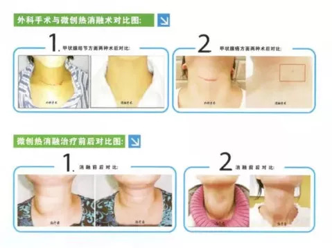 上海三甲医院甲状腺专家9月出诊预告