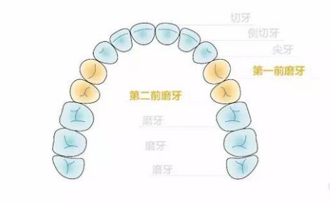 第一前磨牙是拔牙矫正中最常拔除的对象,大部分患者拔除第一前磨牙(4