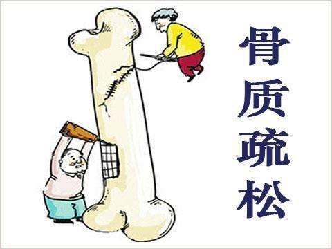 体检查出骨质疏松,没症状就真的不用治疗吗?