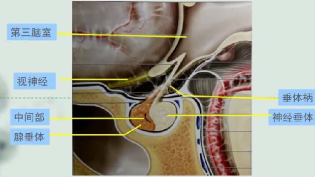 垂体丨正常表现垂体瘤丨影像诊断