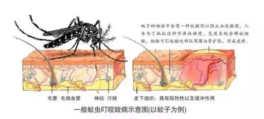 一只蚊子引发的血案