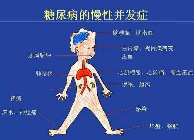 高血糖的原理是什么呢_高血糖吃什么食物好