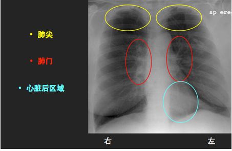 ②右肺有三叶(上叶,中叶,下叶),由水平裂和斜裂分隔.