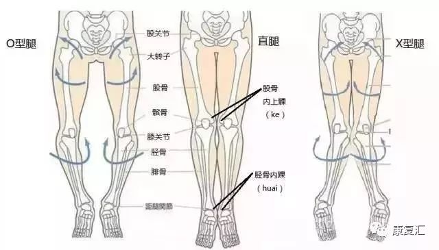 如果想判断骨头是否弯了,最直接的方法是拍x线正位片.