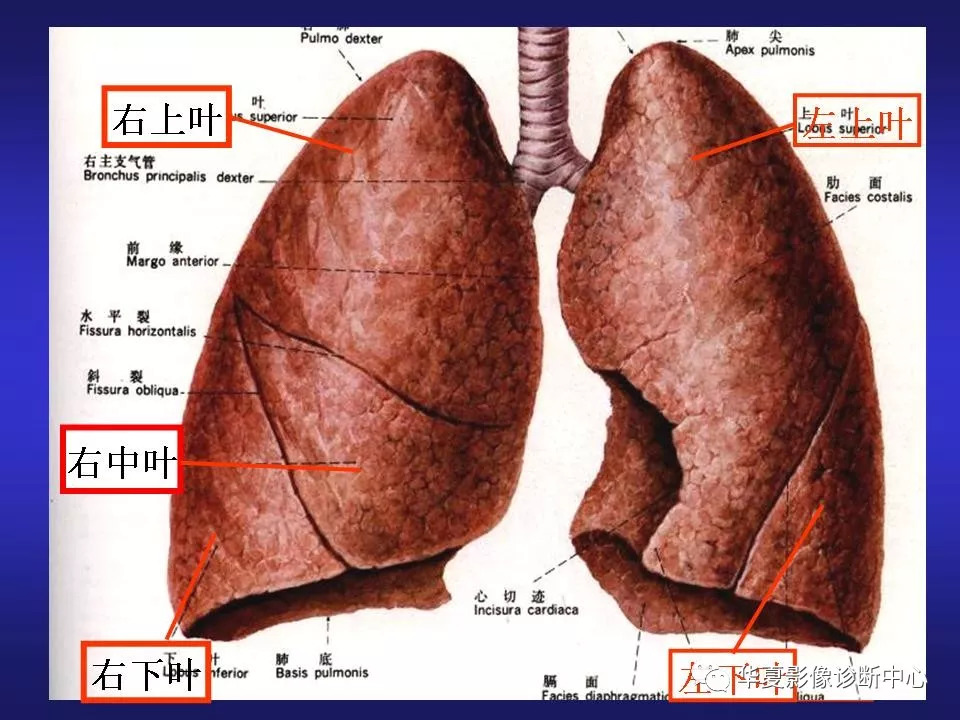 胸部ct解剖及常见病变诊断