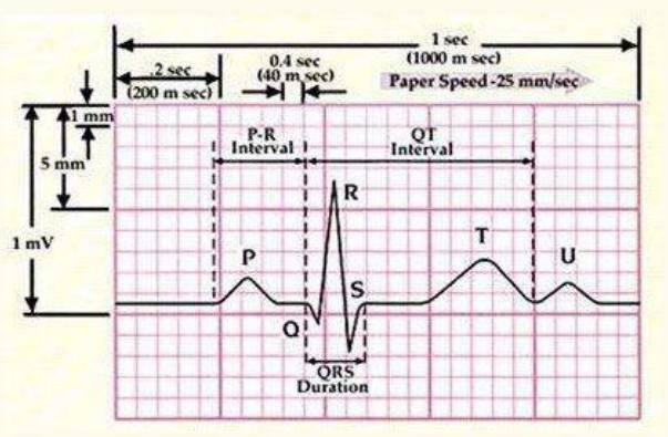 心电图测量你需要知道的一些常识看完秒懂
