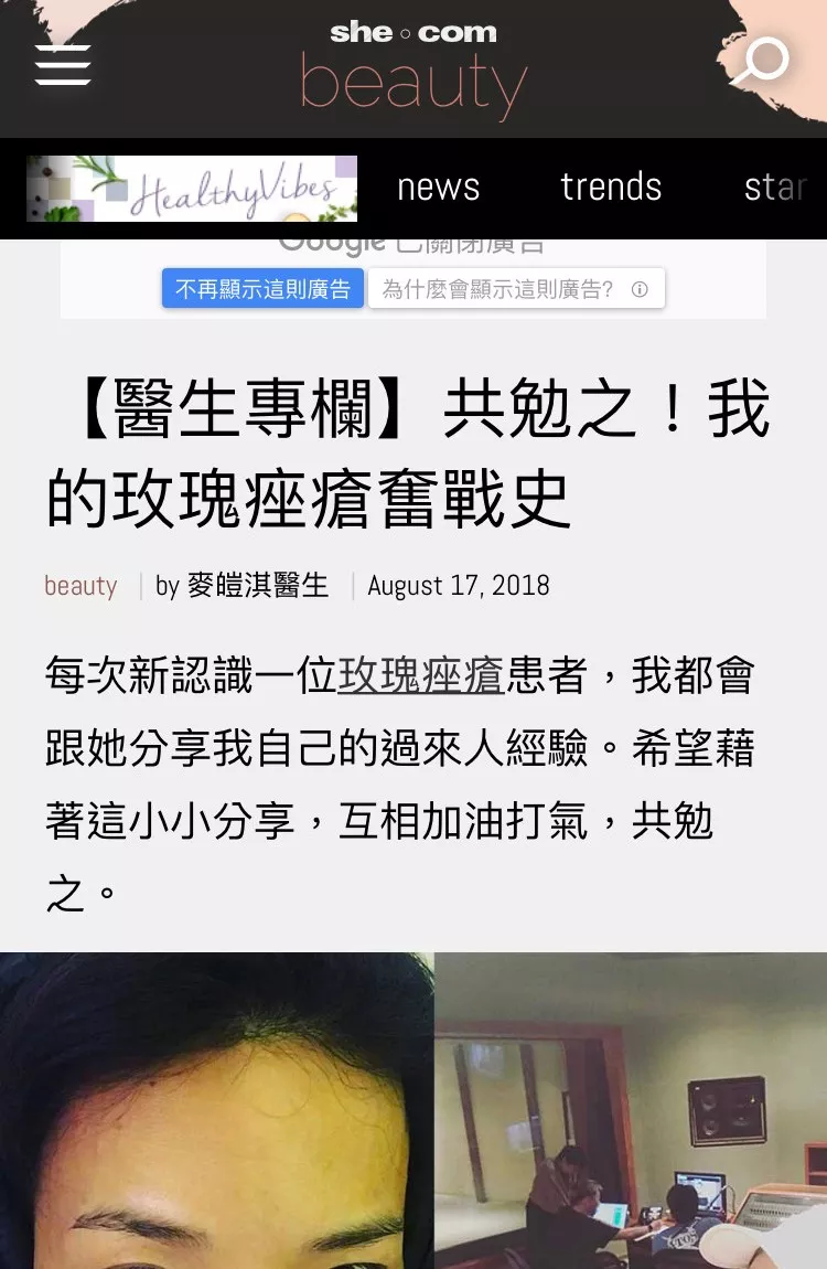 医生亲身经历,分享我是如何战胜玫瑰痤疮的_皮肤