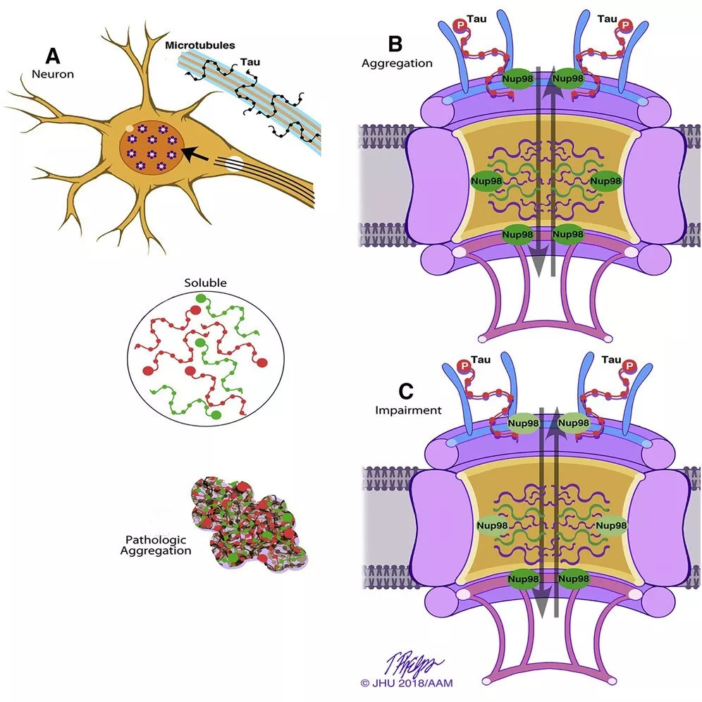 tau蛋白与nup98结合导致tau蛋白聚集和核孔复合体功能失常(图片来源