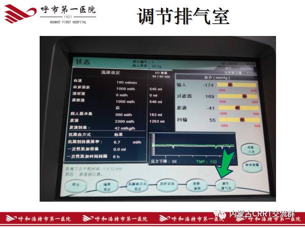 图解crrt治疗全过程,一看保证能学会(金宝)!