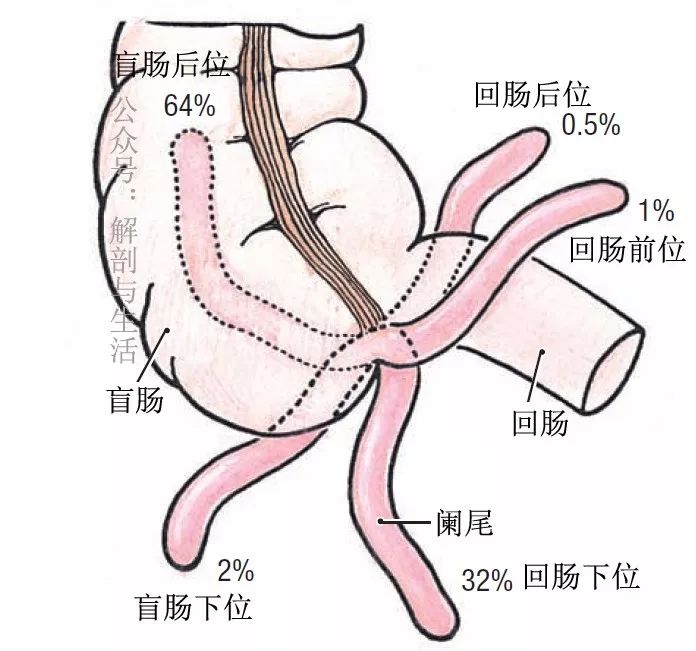 阑尾解剖