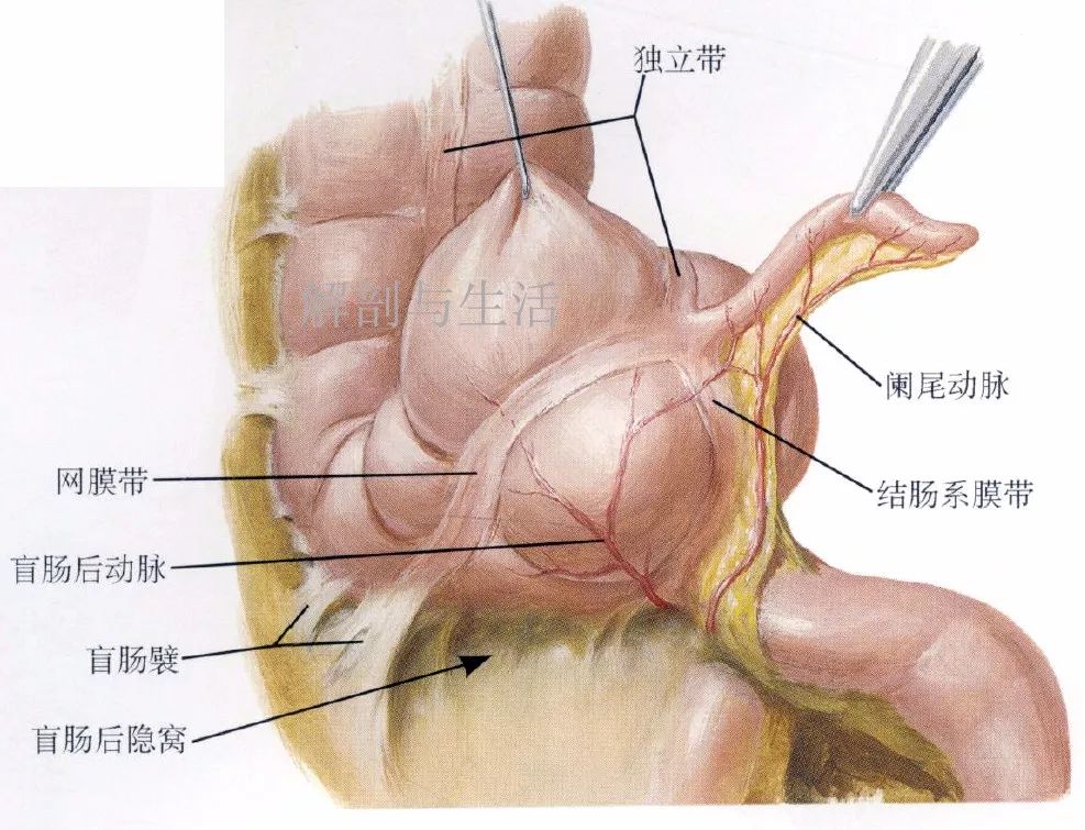 阑尾解剖